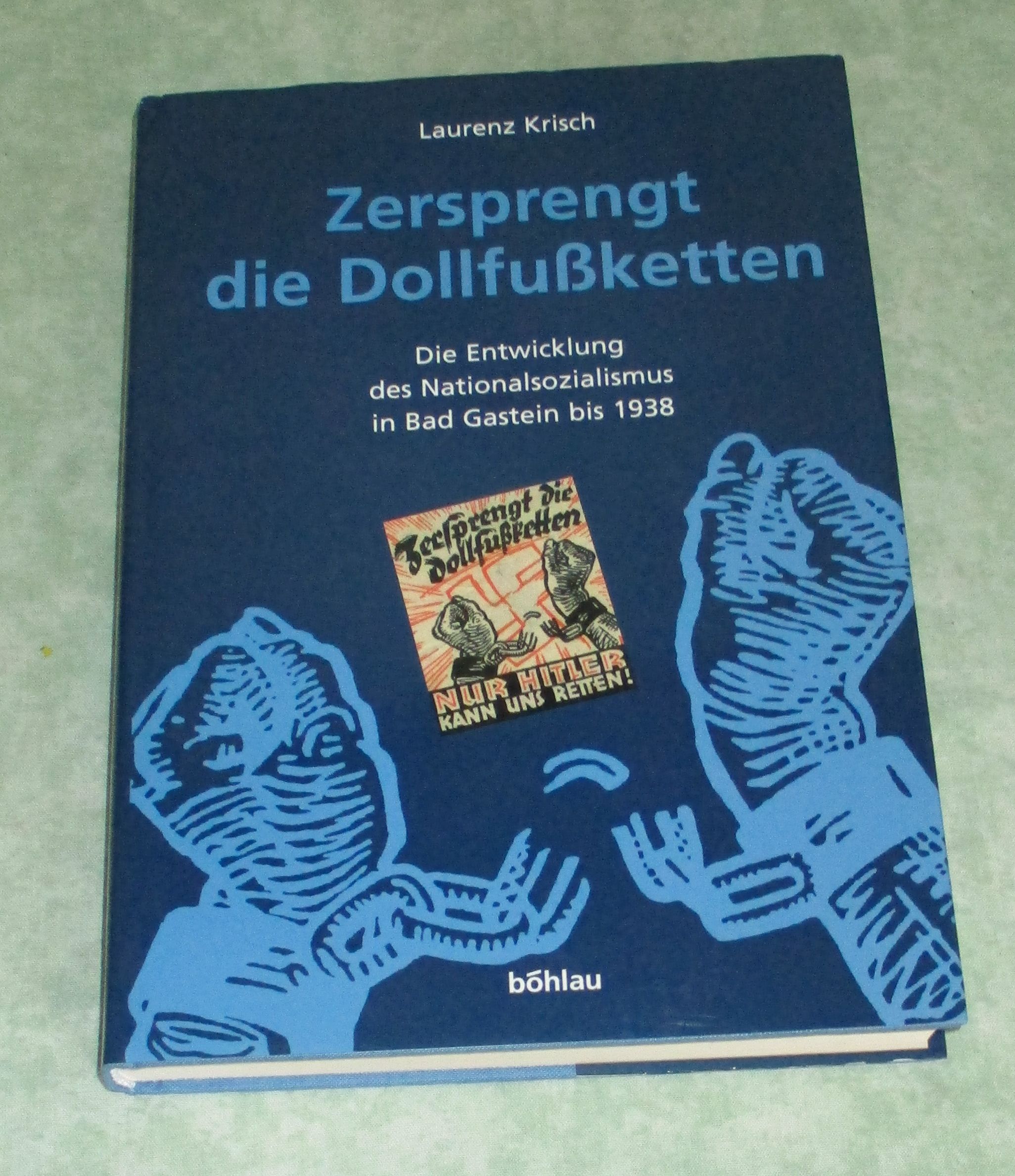 Dollfußketten
